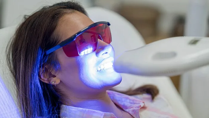 Teeth Whitening